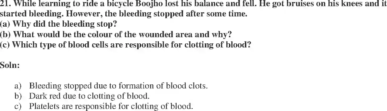 NCERT-Solution-Class-7-Science-Exemplar-Transportation-in-Animals-and-Plants-Exemplar-3783-page-8